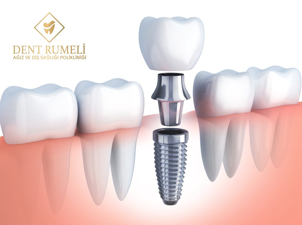 Dent Rumeli_2